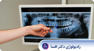 Cover_Image