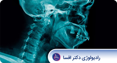 Cover_Image
