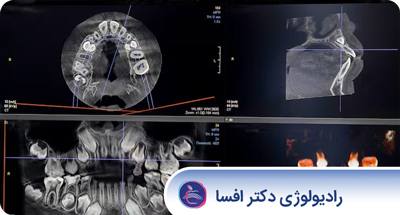 Cover_Image