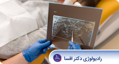 رادیوگرافی های مرتبط با درمان های معمول و پیچیده دندانپزشکی