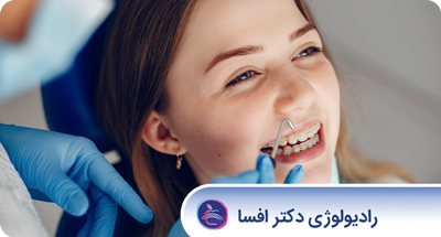 تهیه فوتوگرافی های مورد نیاز برای انواع درمان های ارتودنسی و جراحی های زیبایی 