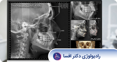 قبل از انجام رادیولوژی دندان چه نکاتی را باید رعایت کنیم؟ راهنمای کامل آمادگی بیمار
